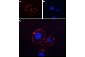 Expression of P2RX3 in rat PC12 cells - Cell surface detection of P2RX3 in intact living rat pheochromocytoma (PC12) cells.