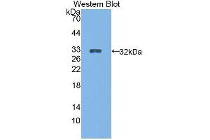Western Blotting (WB) image for anti-Cytochrome P450, Family 27, Subfamily B, Polypeptide 1 (CYP27B1) (AA 251-500) antibody (ABIN1862408) (CYP27B1 anticorps  (AA 251-500))