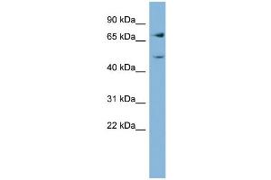 WB Suggested Anti-GFPT2  Antibody Titration: 0. (GFPT2 anticorps  (Middle Region))