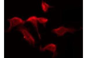 ABIN6276050 staining HuvEc by IF/ICC.