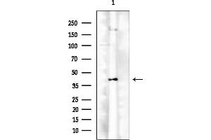 anti-Stromal Cell Derived Factor 4 (SDF4) antibody