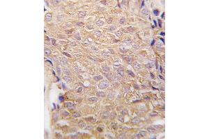 Immunohistochemistry (IHC) image for anti-Aldehyde Dehydrogenase 6 Family, Member A1 (ALDH6A1) antibody (ABIN2998169) (ALDH6A1 anticorps)