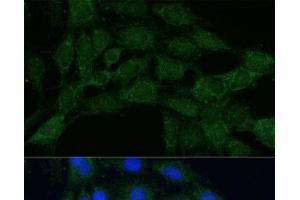 Immunofluorescence analysis of C6 cells using MTHFD2 Polyclonal Antibody at dilution of 1:100.