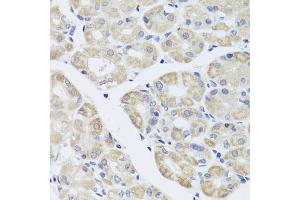 Immunohistochemistry of paraffin-embedded human stomach using DISC1 antibody. (DISC1 anticorps)