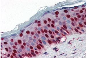 Human Skin (formalin-fixed, paraffin-embedded) stained with NPM1 antibody ABIN364324 at 5 ug/ml followed by biotinylated anti-mouse IgG secondary antibody ABIN481714, alkaline phosphatase-streptavidin and chromogen. (NPM1 anticorps  (AA 81-294))