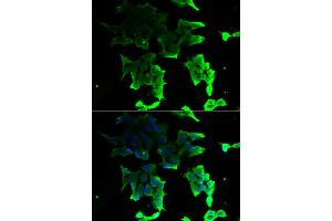 Immunofluorescence analysis of HeLa cells using TANK antibody (ABIN5974093). (TANK anticorps)