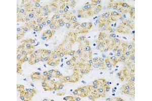 Immunohistochemistry of paraffin-embedded Human liver using SLC16A4 Polyclonal Antibody at dilution of 1:100 (40x lens). (SLC16A4 anticorps)