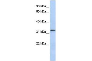 WB Suggested Anti-LACTB2 Antibody Titration: 0.