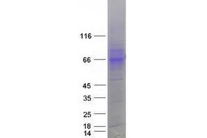 Validation with Western Blot