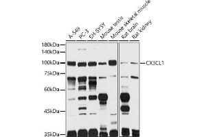 Western blot analysis of extracts of various cell lines, using CX3CL1 antibody (ABIN6129035, ABIN6139265, ABIN6139266 and ABIN6218481) at 1:1000 dilution. (CX3CL1 anticorps  (AA 365-397))