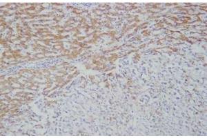 IHC: Immunohistochemical analysis of Ficolin-2 in frozen human liver tissue using mAb GN5 (Ficolin 2 anticorps)