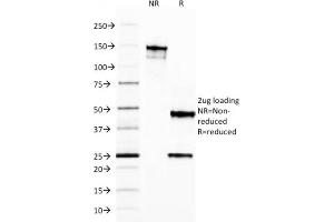 SDS-PAGE Analysis Purified Ferritin, Light Chain Mouse Monoclonal Antibody (FTL/1387).