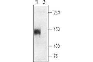 Western blot analysis of rat skeletal muscle: - 1. (CACNA1S anticorps  (2nd Extracellular Loop, Domain 4))