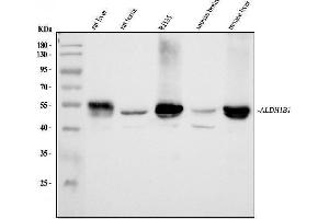 Western blot analysis of ALDH1B1 using anti-ALDH1B1 antibody (ABIN4886450).