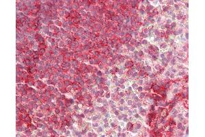 Anti-LFA-1 / CD11a antibody IHC staining of human spleen. (ITGAL anticorps  (AA 722-751))