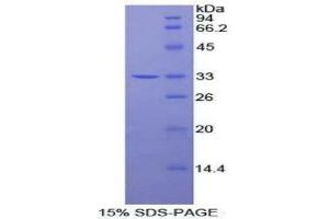 SDS-PAGE (SDS) image for 3-phosphoinositide Dependent Protein Kinase-1 (PDPK1) (AA 83-338) protein (His tag) (ABIN1878004)