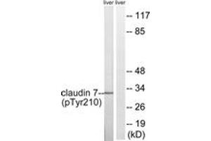 Western blot analysis of extracts from rat liver, using Claudin 7 (Phospho-Tyr210) Antibody. (Claudin 7 anticorps  (pTyr210))
