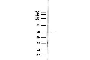 anti-Forkhead Box D2 (FOXD2) antibody