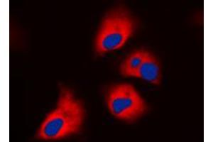 Immunofluorescent analysis of S6K1 (pT444) staining in HepG2 cells. (RPS6KB1 anticorps  (C-Term, pSer444))