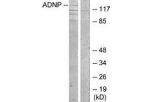 Western Blotting (WB) image for anti-Activity-Dependent Neuroprotector Homeobox (ADNP) (AA 111-160) antibody (ABIN2889758) (ADNP anticorps  (AA 111-160))