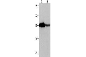 Western Blotting (WB) image for anti-Chromobox Homolog 2 (CBX2) antibody (ABIN2427917) (CBX2 anticorps)