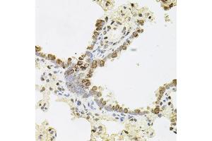 Immunohistochemistry of paraffin-embedded rat lung using REG3A antibody (ABIN6132545, ABIN6146855, ABIN6146856 and ABIN6216122) (40x lens). (REG3A anticorps  (AA 27-175))