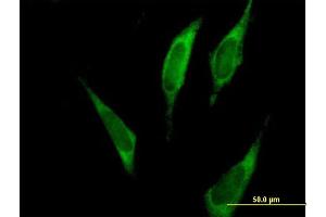 Immunofluorescence of purified MaxPab antibody to FARSLA on HeLa cell.