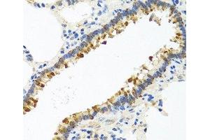 Immunohistochemistry of paraffin-embedded Rat lung using CST4 Polyclonal Antibody at dilution of 1:100 (40x lens). (CST4 anticorps)