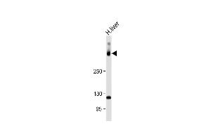 Anti-SYNE2 Antibody (N-Term) at 1:1000 dilution + Human liver lysate Lysates/proteins at 20 μg per lane. (SYNE2 anticorps  (AA 1843-1877))