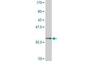 Western Blot detection against Immunogen (35. (USP49 anticorps  (AA 275-362))