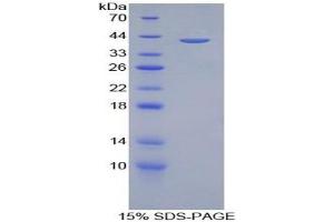 SDS-PAGE of Protein Standard from the Kit (Highly purified E. (Amphiregulin Kit CLIA)