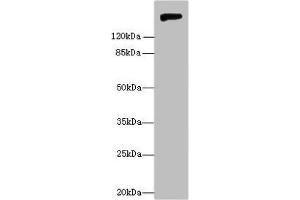 Western blot All lanes: Nid1 antibody at 6 μg/mL + Rat lung tissue Secondary Goat polyclonal to rabbit IgG at 1/10000 dilution Predicted band size: 137 kDa Observed band size: 150 kDa (Nidogen 1 anticorps  (AA 428-665))