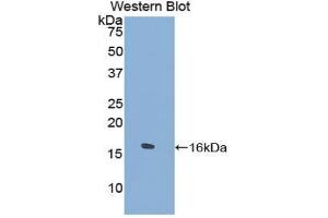 Western blot analysis of the recombinant protein. (TPSD1 anticorps  (AA 99-191))