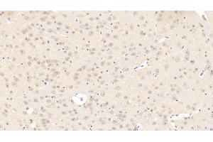 Detection of CACNa1C in Mouse Cerebrum Tissue using Polyclonal Antibody to Calcium Channel, Voltage Dependent, L-Type, Alpha 1C Subunit (CACNa1C)