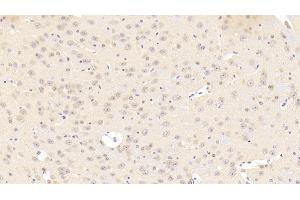 Detection of CACNa1C in Mouse Cerebrum Tissue using Polyclonal Antibody to Calcium Channel, Voltage Dependent, L-Type, Alpha 1C Subunit (CACNa1C) (CACNA1C anticorps  (AA 1978-2139))
