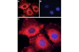 Expression of ASIC1 in rat C6 glioma cells - Immunocytochemical staining of fixed and permeabilized C6 glioma cells. (ASIC1 anticorps  (C-Term, Intracellular))