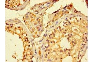 Immunohistochemistry of paraffin-embedded human testis tissue using ABIN7160851 at dilution of 1:100 (SIRT1 anticorps  (AA 2-747))
