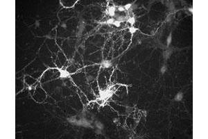 Immunochemical staining of cultured mouse caudate neurons with Ppp1r1b polyclonal antibody . (DARPP32 anticorps  (N-Term))