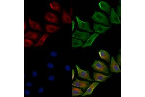 anti-Melanin-Concentrating Hormone Receptor 1 (MCHR1) (Internal Region) antibody