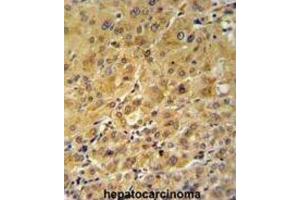 Immunohistochemistry (IHC) image for anti-FK506 Binding Protein 1A, 12kDa (FKBP1A) antibody (ABIN3003472)