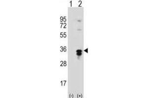 Western Blotting (WB) image for anti-Palmitoyl-Protein Thioesterase 1 (PPT1) antibody (ABIN3001553)