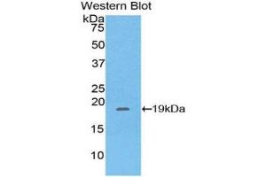 Western Blotting (WB) image for anti-Pleckstrin Homology-Like Domain, Family A, Member 2 (PHLDA2) (AA 9-140) antibody (ABIN1860206) (PHLDA2 anticorps  (AA 9-140))