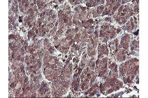 Image no. 6 for anti-serpin Peptidase Inhibitor, Clade B (Ovalbumin), Member 1 (SERPINB1) (AA 77-306) antibody (ABIN1491671)