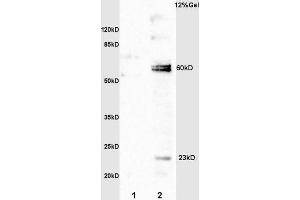 L1 rat kidney lysates L2 rat brain lysates probed with Anti IL-20R alpha/IL20RA Polyclonal Antibody, Unconjugated (ABIN748103) at 1:200 overnight at 4 °C.