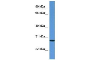 Western Blot showing EDN3 antibody used at a concentration of 1 ug/ml against Fetal Kidney Lysate (Endothelin 3 anticorps  (C-Term))