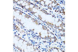 Immunohistochemistry of paraffin-embedded human colon using GIP antibody (ABIN1882357) at dilution of 1:100 (40x lens). (GIP anticorps)