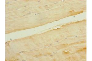 Immunohistochemistry of paraffin-embedded human skeletal muscle tissue using ABIN7170019 at dilution of 1:100