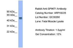 WB Suggested Anti-SPINT1  Antibody Titration: 0. (SPINT1 anticorps  (C-Term))