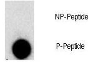 Dot blot analysis of phospho-FGFR1 antibody.