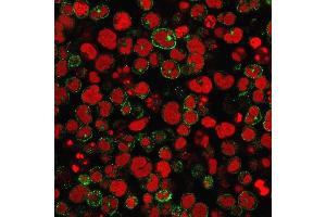 Immunofluorescence staining of MOLT-4 cells using CD2 Mouse Monoclonal Antibody (1E7E8. (CD2 anticorps)